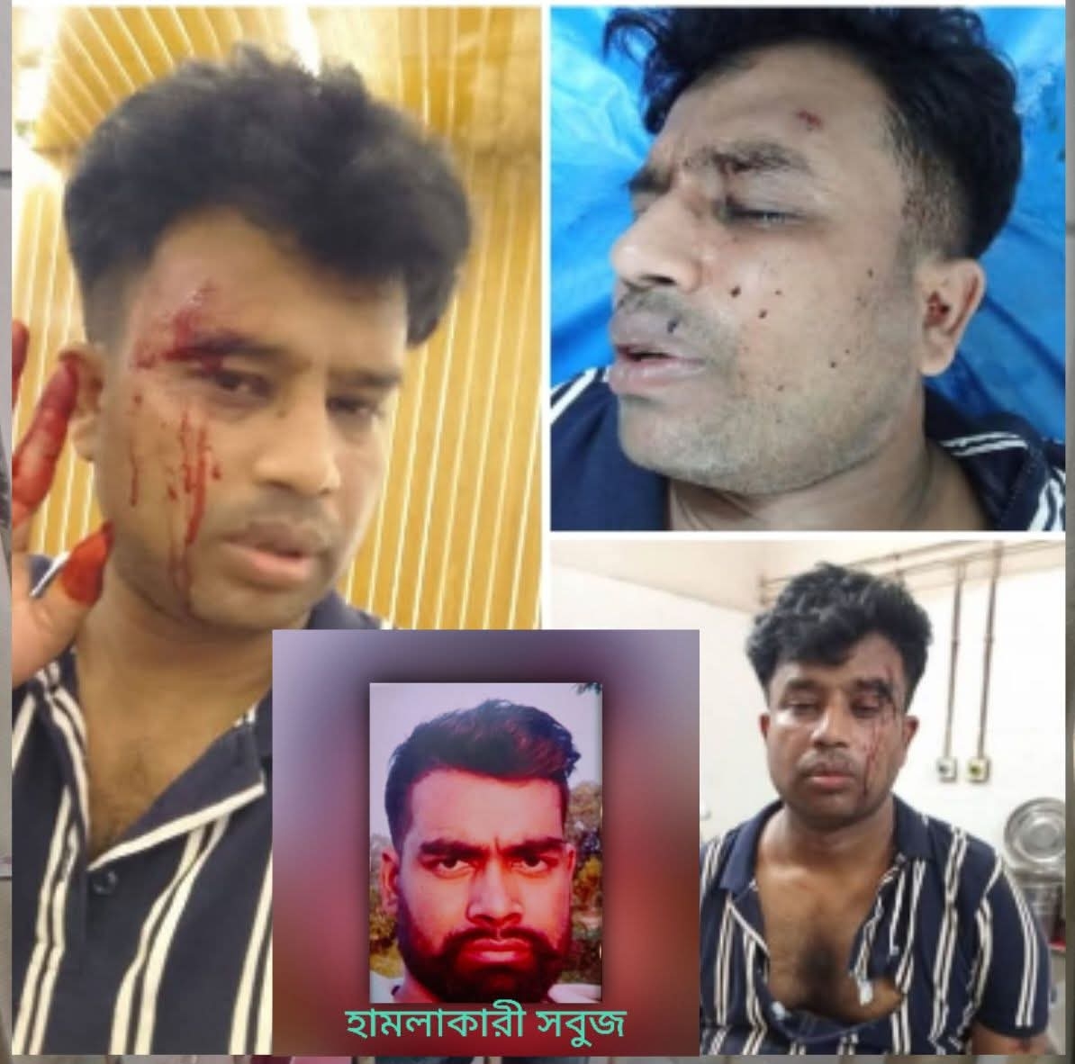 হোটেল ঈগলে হামলা, ভাঙচুর ও লুটপাট: থানায় মামলা দায়ের