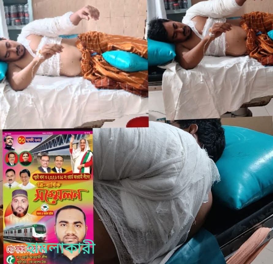 হুমকি থেকে হামলা—পল্লবীতে সাবেক স্বামীসহ কয়েকজনের বিরুদ্ধে গুরুতর অভিযোগ